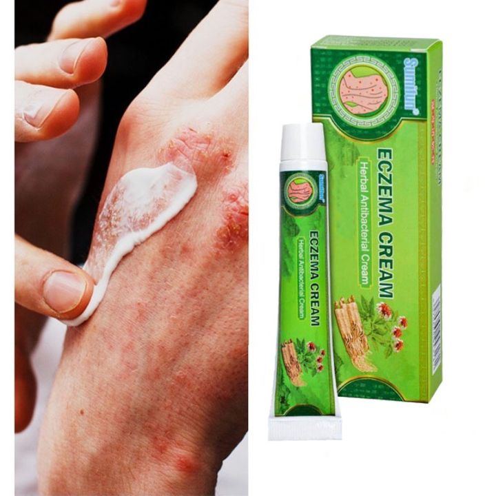 Sumifun Eczema Cream Herbal Antibacterial Cream Psoriasis Itchy skin ...