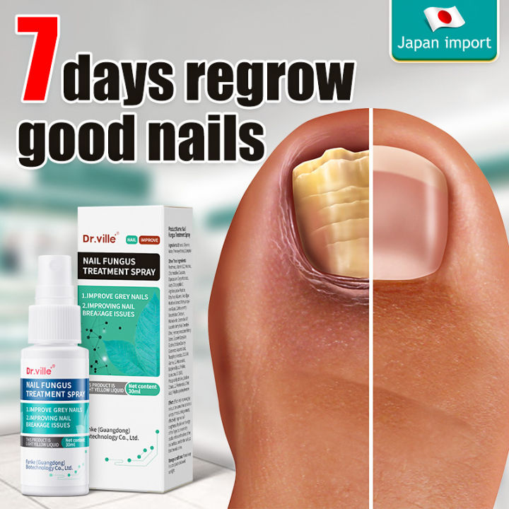 FUNGUS 完売間近！！ Japan Nail Fungus Treatment Care Fluid Nail Repair Spray
