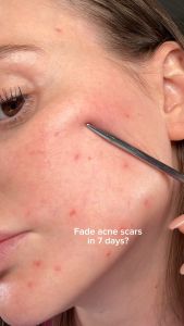 Tinh chất Eqqualberry Serum 30ml