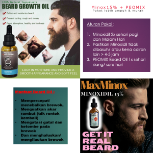 Minoxidil 10% Penumbuh Brewok dan Rambut anti BOTAK dan RONTOK
