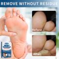 Plester Kutil Mata Ikan untuk Kaki Kapalan Foot Corn Removal Plaster Koyo Penghilang Mata Ikan12pcs plester mata ikan,obat mata ikan di telapak kaki,plaster mata ikan. 