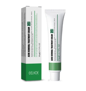 กำจัดสิว 20ML สลายสิวอุดตันที่ต้นตอ อ่อนโยนและไม่ระคาย เจลแต้มสิว