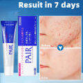 Japan Lion Pair Acne Remover Cream Face Acne Pimple Treatment Skin Repair Acne Pimples Scar Removal 24g. 