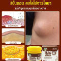vivistyle ยาทากำจัดเนื้องอกไขมัน (กำจัดเนื้องอกไขมันใน 7 วัน). 