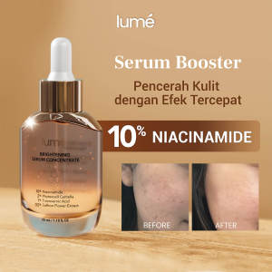 Lume  Brightening Concentract  Serum Mencerahkan Wajah