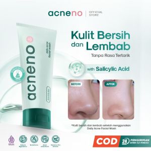 ACNENO Facial Wash 80gr – Facial Cleanser anti jerawat with Salicylic Acid | Original BPOM Halal