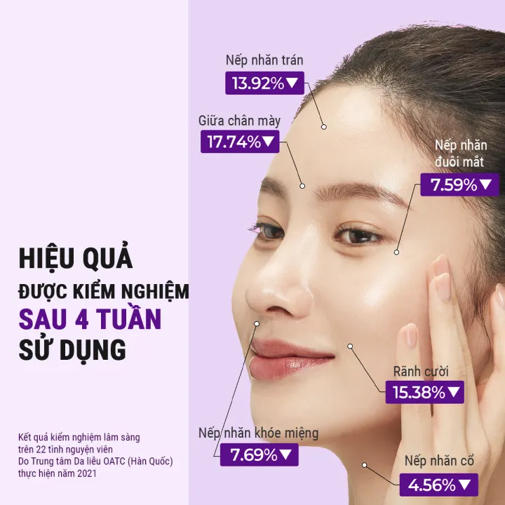 Kem%20d%C6%B0%E1%BB%A1ng%20m%E1%BA%AFt%20Some%20By%20Mi%20Retinol%200.1%25%20Intense%20Advanced%20Triple%20Action%20Eye%20Cream%2030ml%20gi%E1%BA%A3m%20qu%E1%BA%A7ng%20th%C3%A2m%20v%C3%A0%20n%E1%BA%BFp%20nh%C4%83n%20-%20Image%205