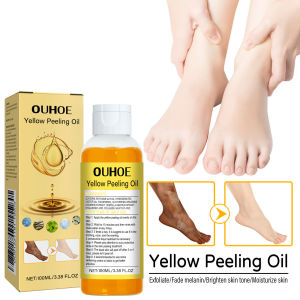 【On Sale】Fight Against Dead Skin Cells! OUHOE Yellow Exfoliating Oil Unclog Pores to Brighten Skin Tone