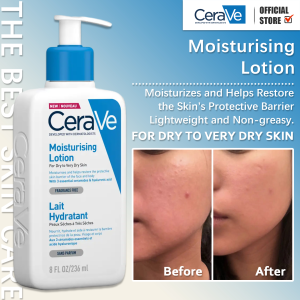Cerave Foaming Cleanser/Moisturizing Lotion /SA Cleanser/Hydrating Cleanser/Itch Relief Lotion/Acne Cleanser/Psoriasis Cleanser