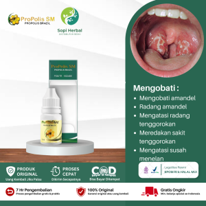 Obat Amandel Obat Amandel Dan Radang Tenggorokan Radang Amandel Obat Amandel Untuk Anak Dan Dewasa - Propolis SM Brazil Asli Original 100%