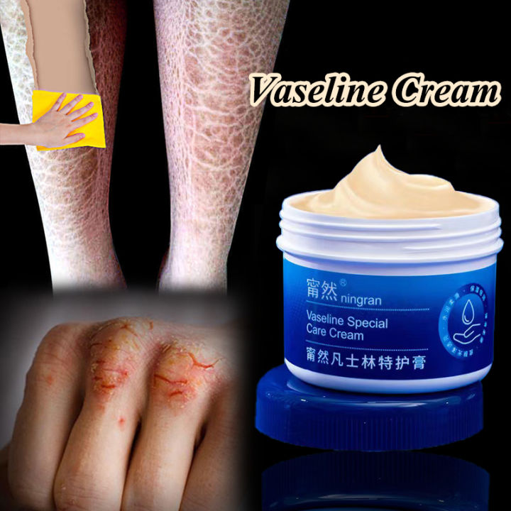 Dry Skin Vaseline Cracked Heel Repair Cream Anti Cracking Cream