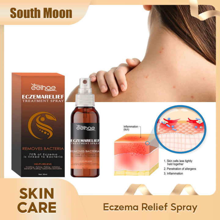 Eelhoe Skin Relieving Spray Hand Foot Scalp Eczema Anti-itch Rash 