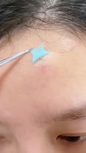 Miếng Dán Mụn Hydrocolloid QUSTERE 400 Miếng Hình Ngôi Sao Giúp Thấm Hút Dịch Tiết Và Bảo Vệ Vùng Da Có Khuyết Điểm Phù Hợp Mọi Loại Da