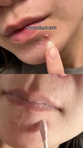 Dung Dịch Chấm Mụn Mario Badescu Drying Lotion Giảm ViêmGom Còi Nhanh 29ml Dhskincare