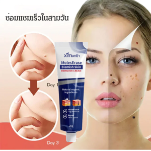 ครีมลดหลุมสิวและรอยดำบริเวณผิวหน้า - 5w5Oo0mI