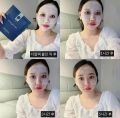 Mặt nạ Derm All Matrix - Mặt nạ Matrix dưỡng trắng nâng cơ cấp nước tức thời - Hộp 4 miếng. 