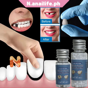 [30ml/box]Moldable Diy Gigi Palsu Dental Resin Temporary Tooth Repair Teeth Gap Falseteeth Solid Glue Denture Adhesive Teeth Repair Dental