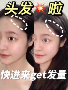 The new Minoan medicine artifact red and blue light hair growth comb healthy hair development hair comb hair growth instrument anti-hair loss massage comb新款米诺上药神器红蓝光生发梳健发育发梳生发仪防脱发按摩梳