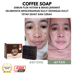 Sabun Wajah Premium SK12 dengan Rasa Kopi Arabica - Penghilang Flek Hitam & Pencerah Kulit untuk Kulit Sensitif