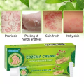 SUMIFUN ECZEMA CREAM HERBAL ANTI BACTERIAL CREAM PSORIASIS DERMATITIS ...