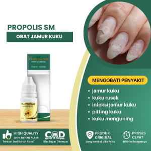 Obat Jamur Kuku Obat Penumbuh Kuku Rusak Obat Infeksi Jamur Kuku Salep Jamur Kuku Di tangan Obat Proriasis Kuku Kuku Mati Bau Busuk - PROPOLIS SM