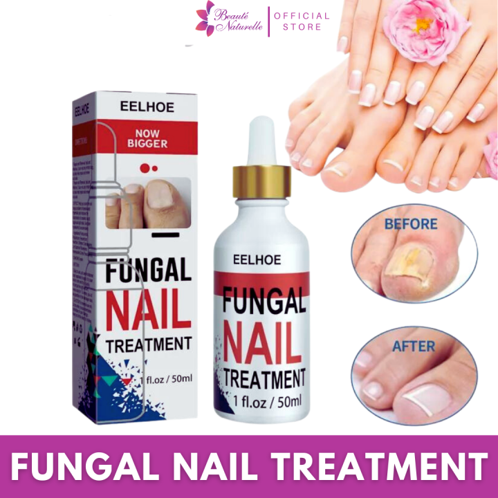 ORIGINAL!!! Nail Fungal Solution Foot Nail Fungus Removal Gel Anti ...