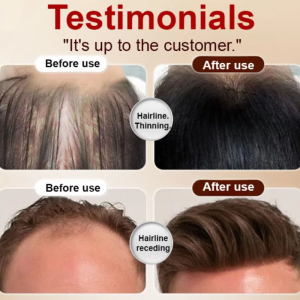 Ginseng Follicle Cleansing Shampoo Anti Hair Loss Anti-Dandruff Shampoo Fast Growth Shampoo Repair Damage Scalp Treatment