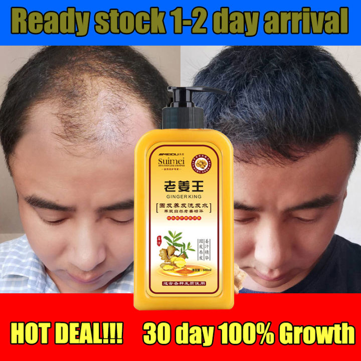 100 Original Ginger Hair Shampoo Anti Hair Loss Nourish Hair Fast Powerful Hair Growth Liquid 6877