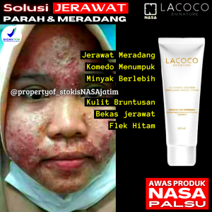 Sabun Penghilang Jerawat dan Bekas nya Facial Wash Moringa Acne Brightening 100% ORIGINAL Brightening Body Wash Penghilang Flek Hitam Paling Ampuh Mengecilkan Pori Pori Sabun Cuci Muka Jerawat dan Bekas Jerawat Sabun Wajah Penghilang Flek Hitam Membandel