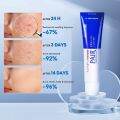 Japan Lion Pair Acne Remover Cream Face Acne Pimple Treatment Skin Repair Acne Pimples Scar Removal 24g. 