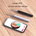 NE3-D Visual Ear Pick with Camera - HD Otoscope for Adults/Kids, 8-Piece Set with Headband & Magnifying Light, 50mins Battery (Black/White). 
