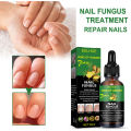 EELHOE Nail Fungus Repair Liquid Remove Onychomycosis Treatment Essence Serum Anti-infective Nourishing Brighten Foot Nail Oil Anti-Fungus Onychomycosis-Removal Liquid Ginger Foot Antifungal Nail Essence. 