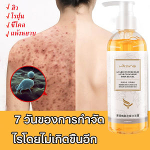 【ซื้อ 2 แถม 1】เจลอาบน้ำสูตรสดชื่นกระจ่างใส สำหรับคนเป็นสิวตามเรือนร่าง  บรรเทาอาการคัน กำจัดไรฝุ่น สิว ยับยั้งไร เจลอาบน้ำกำจัดไร  คุมน้ำมันสดชื่น ผิวเนียนนุ่มสัมผัสสบาย 260 มล.