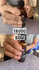Nail Repair Essence 30ml Inhibit Fungal Nail Fungal Treatment Nail fungus