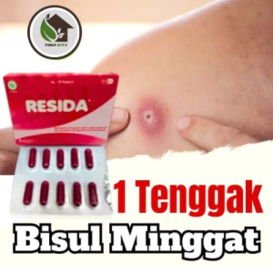 Resida Kapsul Obat Panu Paling Ampuh -Salep Cream Kurap Gatal Gatel Kutu Air Kulit Eksim dan Jamur