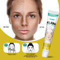 Sumifun Cream Penghilang Flek Hitam Whitening Freckle Cream Krim Bintik Melasma Mencerahkan Kulit Efektif Menghilangkan Bintik Hitam 20g. 