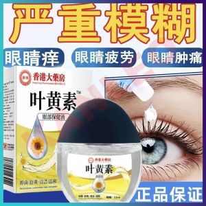 【Local Stock】HongKong Lutein Eye Drops Relieve Eye Fatigue Visual Modelnogli 叶黄素明目滴眼液缓眼疲劳视力模糊干涩止痒消炎眼干深度滋润正品