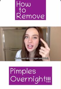 288Pcs Invisible Acne Patch Tea Tree Oil Acne Repair 杀菌修复痘痘贴 Pimple Removal Patch Acne Scar Acne Treatment Sticker