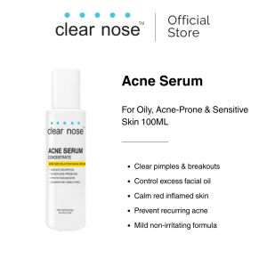 Clear Nose Acne Serum Concentrate 100ml removes pimples and breakouts controls excess facial sebum calming anti‑blemish facial essence for oily acne‑prone sensitive skin