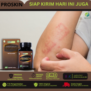 Obat Gatal Kulit Gatal Selangkangan Alergi Gatal Kulit Eksim Kering Basah Biduran Alergi Dingin Makanan - ProSkin