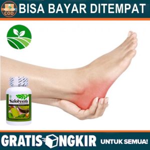 Obat Sakit Tumit Plantar Fascia Plantar Fasciitis Muscle Pull Radang Tumit Bengkak Nyeri Tumit Taji Tumit Radang Tumit Bengkak Nyeri Telapak Kaki Telapak Kaki Panas Telapak Kaki Terasa Baal Kaki Sering Kesemutan Asam Urat Herbal Alami Keloreena