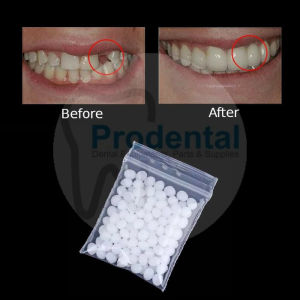Temptooth 150 Butir / Gigi Palsu / Lem Gigi Padat / Gigi Veneer Buat Sendiri