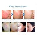 The Ordinary Niacinamide 10% + Zinc 1% 30g face serum skin care facial oli skin. 