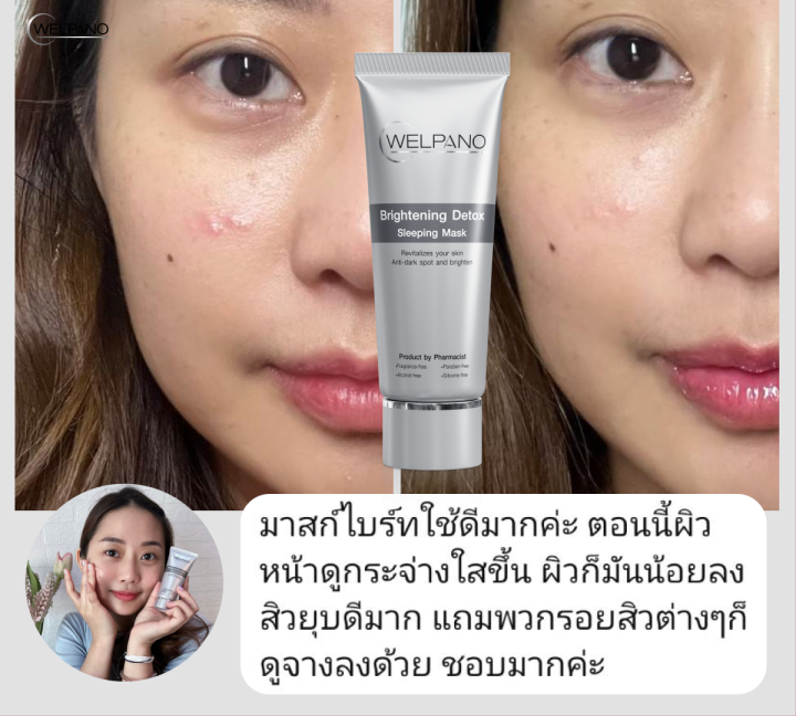 Welpano%20Brightening%20Detox%20Sleeping%20Mask%E0%B8%82%E0%B8%99%E0%B8%B2%E0%B8%94%E0%B8%9E%E0%B8%81%E0%B8%9E%E0%B8%B2%20-%20Image%205
