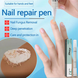 Nail Repair Pen For Home Manicure/Nail Repair Dead Skin Removal/Nail Fungal Care For Women Men/Scientific Ratio/Nutrition