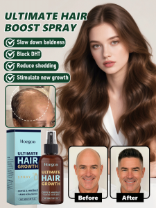 Hair Growth Essence Nutritional Treatment Spray Refreshing Moisturizing Hair Treatment Essence/Hair Growth Essence Treatment Spray Refreshing Moisturizing Hair Nutrient Essence Spray