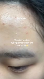 [Reday stock]numbuzin No.5  Essence    Hyaluronic Acid  4% Nicotinamide 5% Glutathione  Vitamin  C   Vitamin Concentrated Essence    Hyperpigmentation   Suitable for Sensitive Skin  South Korea Skin Care   1  Fluid Ounce