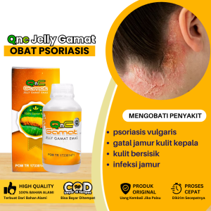 Obat Psoriasis Obat Gatal Jamur Kulit Kepala Obat Kulit Bersisik Obat Kerak Gatal Parah Infeksi Kulit Gatal Obat Ruam Di Kepala Rambut Infeksi Jamur Penghilang Borok Korengan Dengan Qnc Jelly Gamat