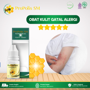 Obat Kulit Gatal Alergi Obat Gatal Seluruh Badan Obat Bintik Merah Gatal Obat Infeksi Jamur Kulit Obat Kulit Ruam Dan Merah Obat Alergi Kulit Gatal Obat Gatal Bagian Kaki Tangan Dan Tubuh Dengan Propolis SM