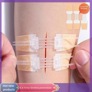 Graceful Zipper Band-aid Painless Wound Closure Patch Suture-free Wound Dressing Patches Zip Suture Reducer Band Aid Outdoor Portable